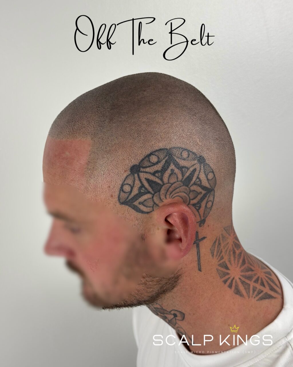 Instagram post from scalpkings. This post is in position 0.