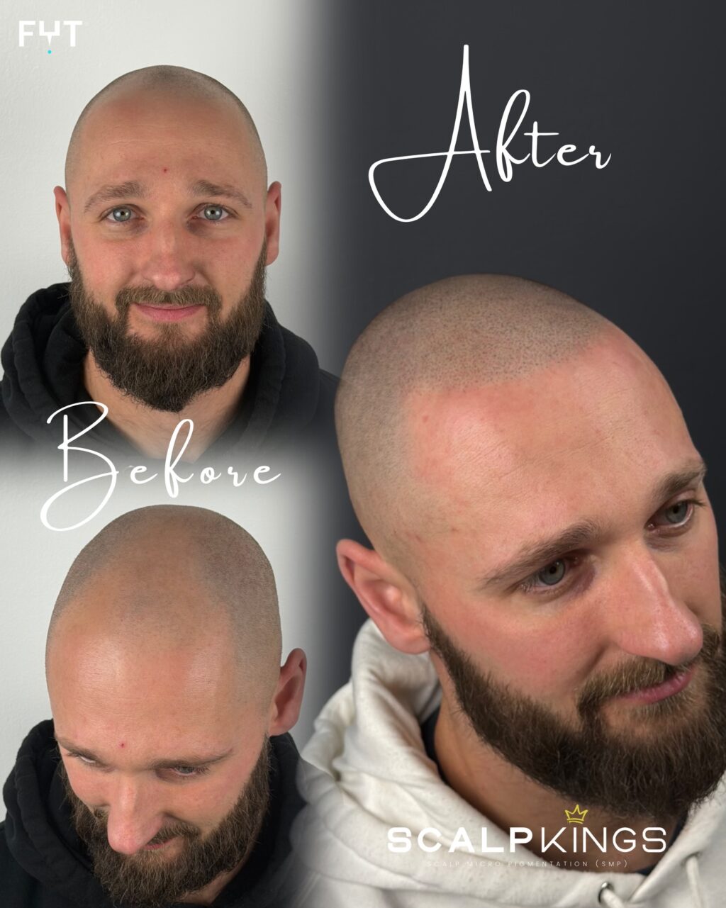 Instagram post from scalpkings. This post is in position 2.