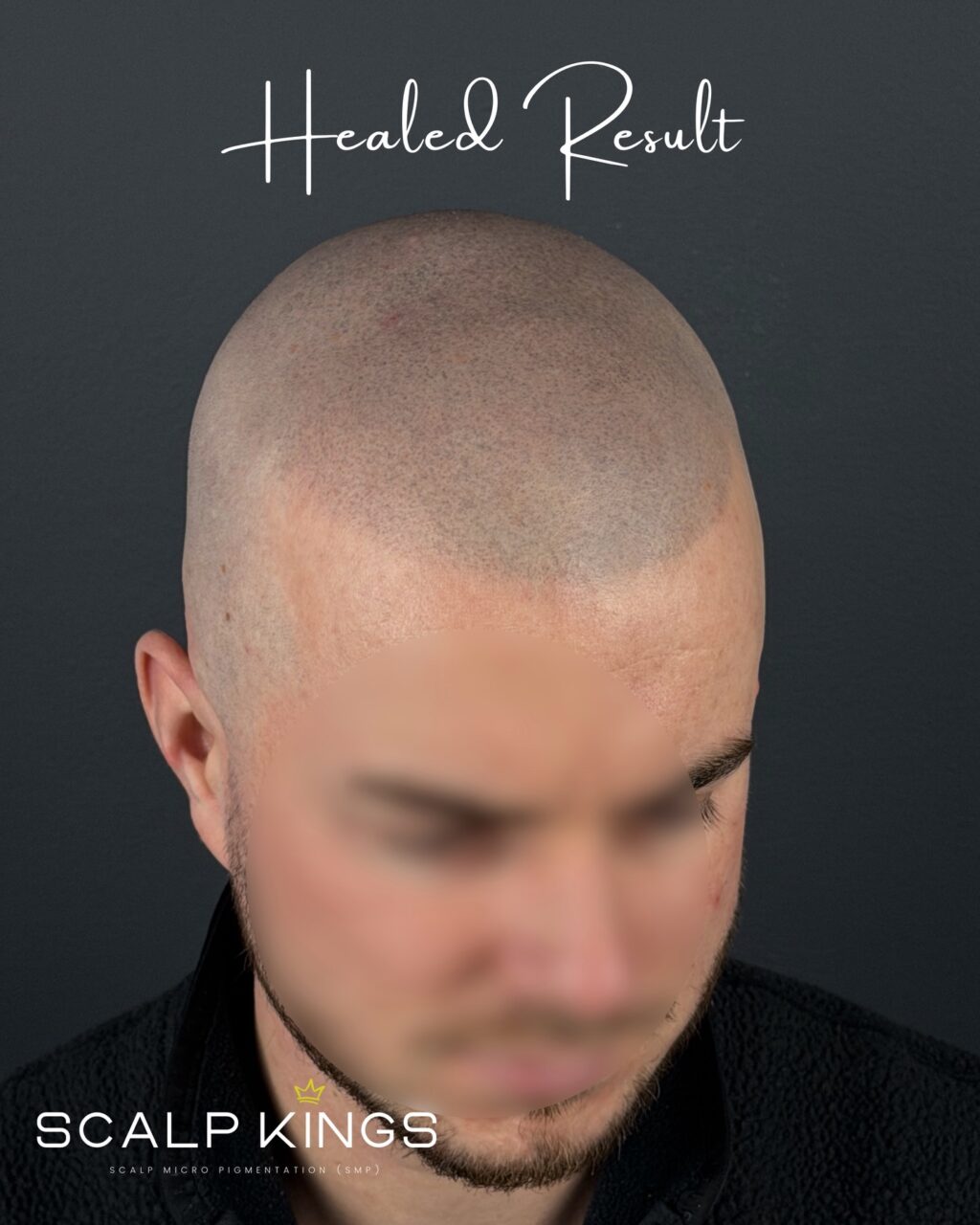 Instagram post from scalpkings. This post is in position 0.