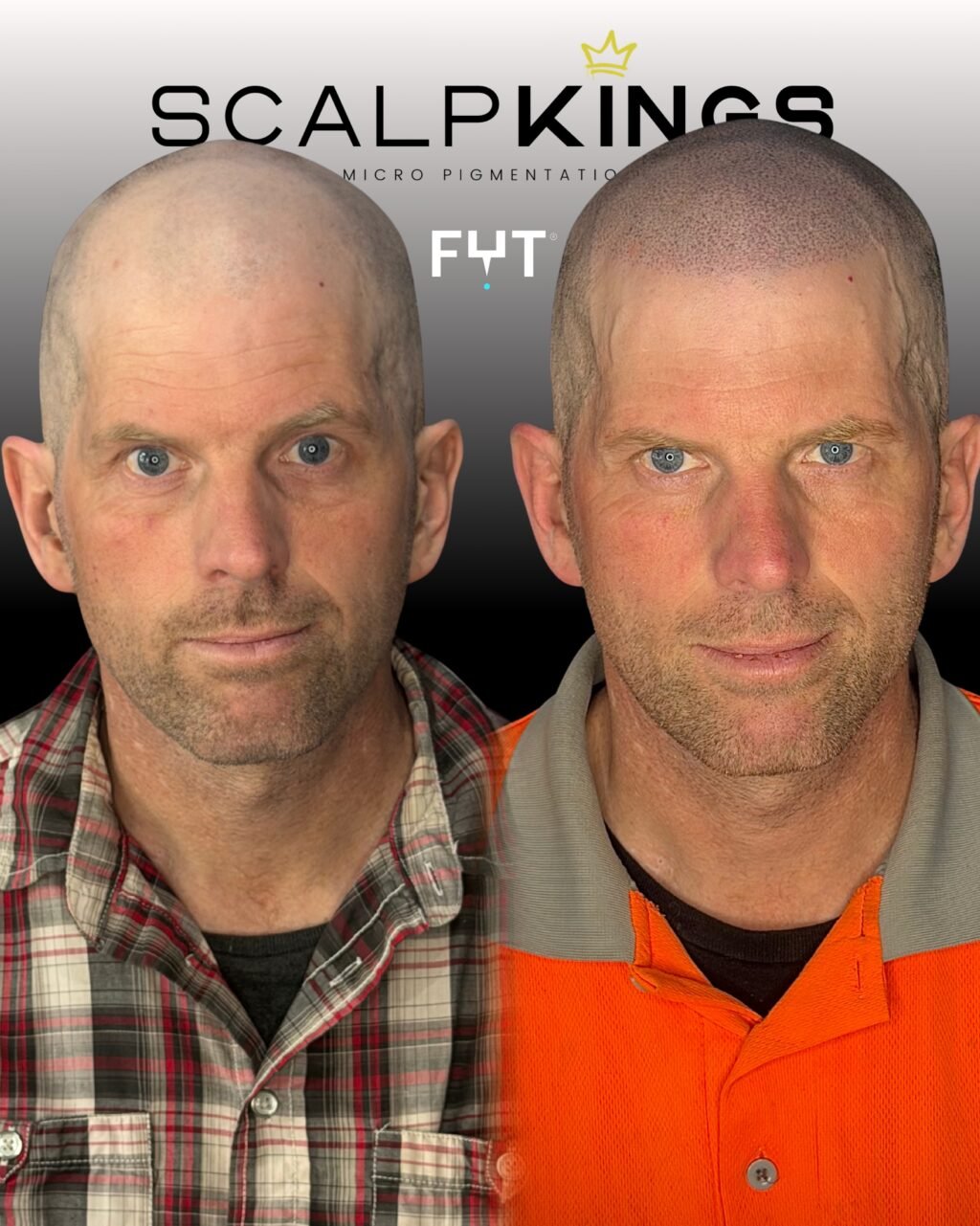 Instagram post from scalpkings. This post is in position 1.