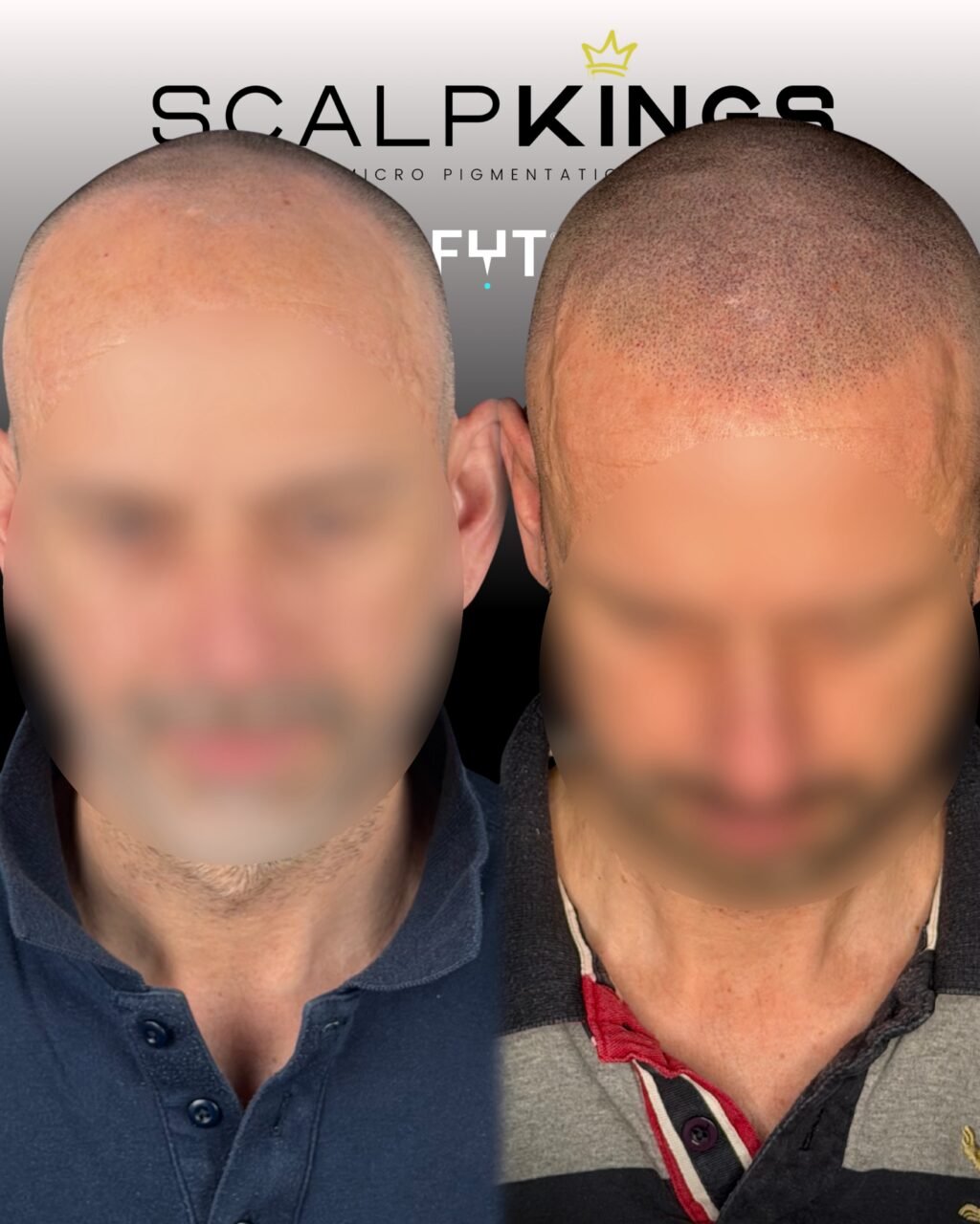 Instagram post from scalpkings. This post is in position 2.