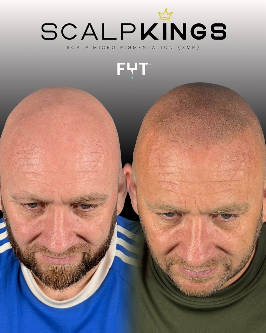 Instagram post from scalpkings. This post is in position 1.