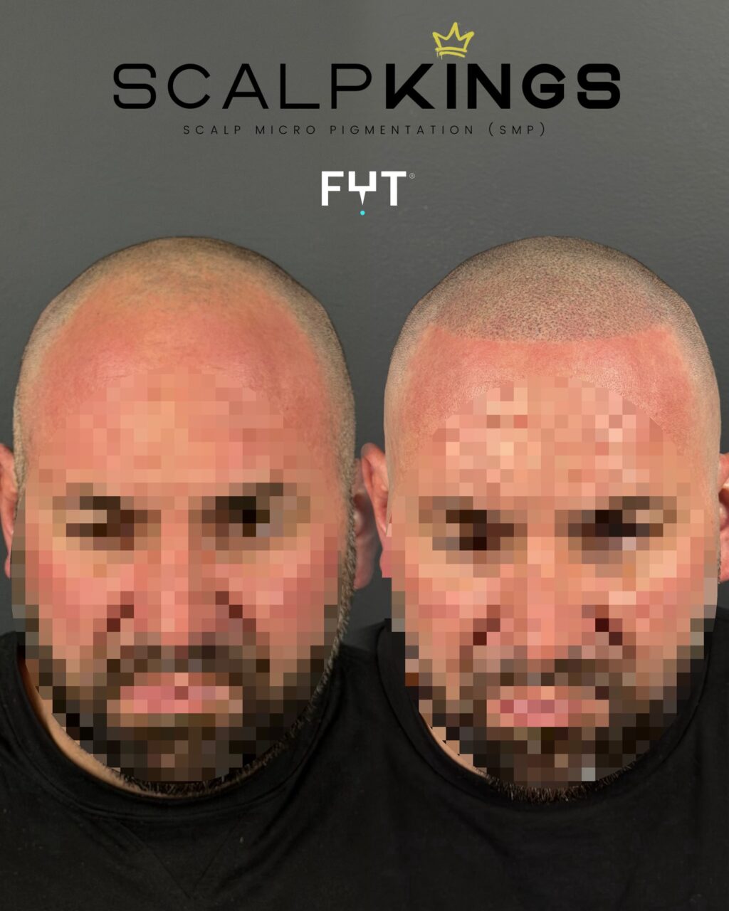 Instagram post from scalpkings. This post is in position 7.