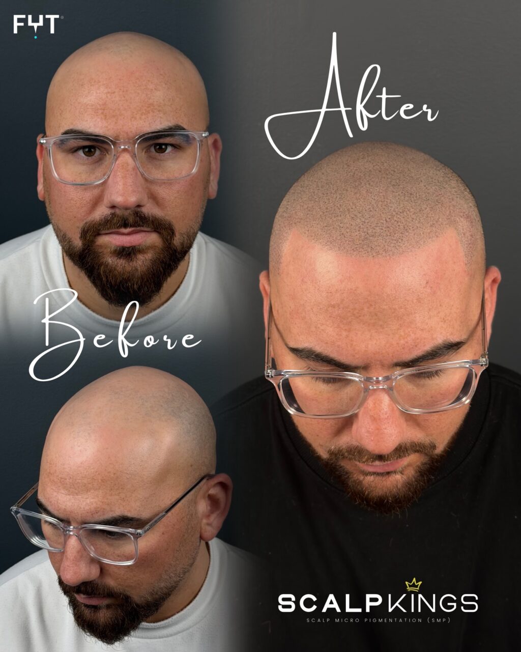 Instagram post from scalpkings. This post is in position 1.