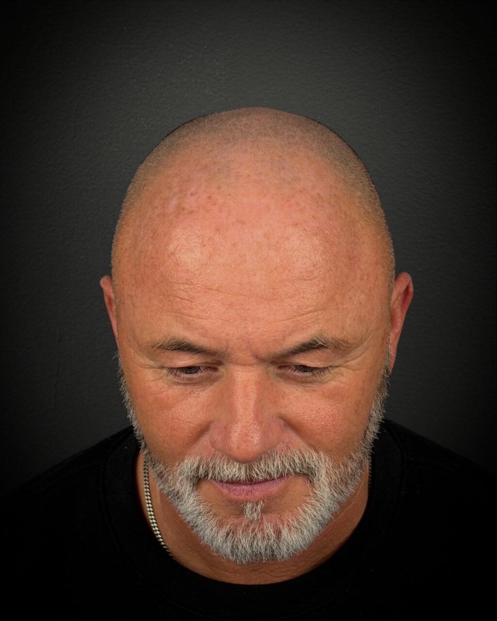 Instagram post from scalpkings. This post is in position 1.