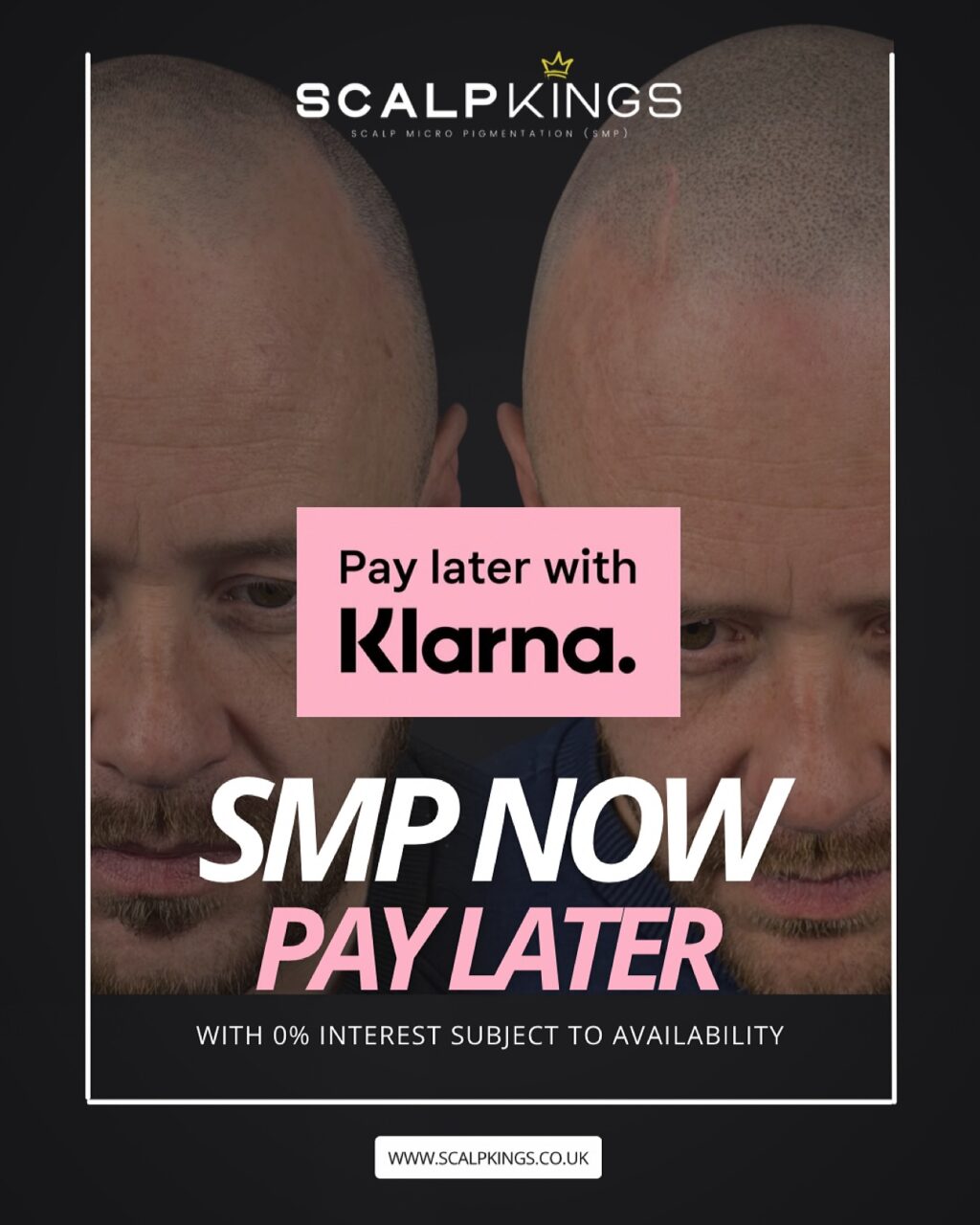 Instagram post from scalpkings. This post is in position 4.