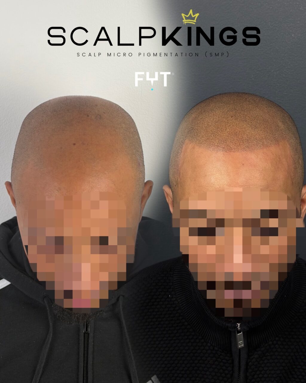 Instagram post from scalpkings. This post is in position 10.