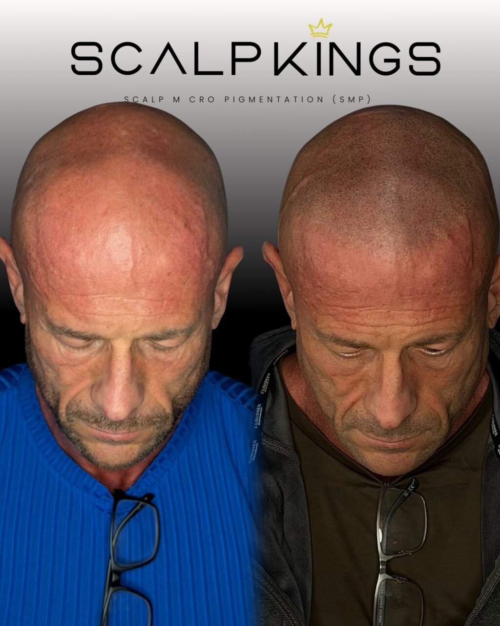 Instagram post from scalpkings. This post is in position 5.