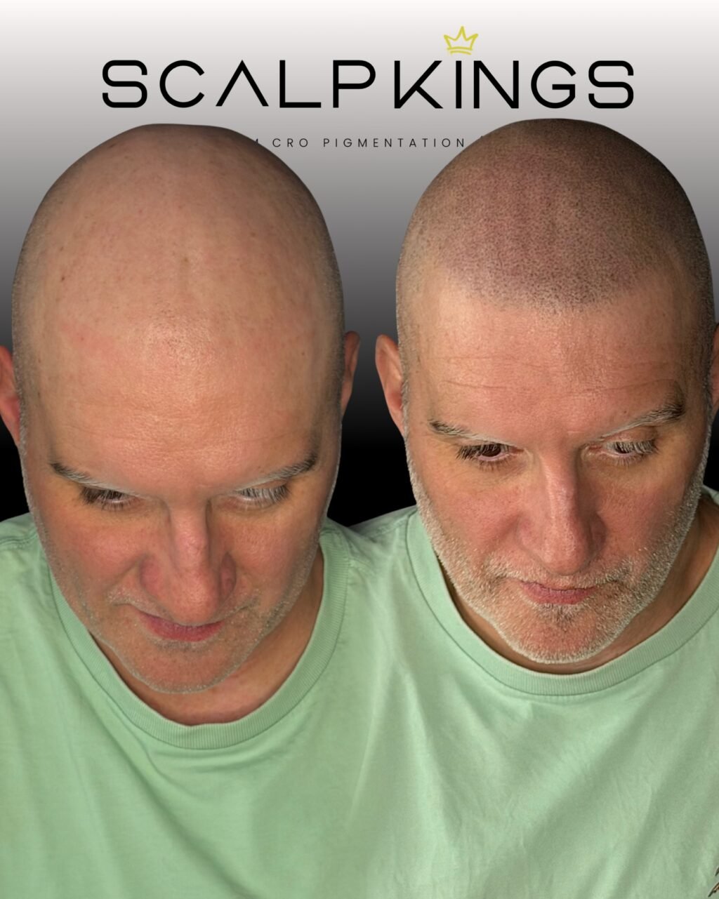 Instagram post from scalpkings. This post is in position 4.