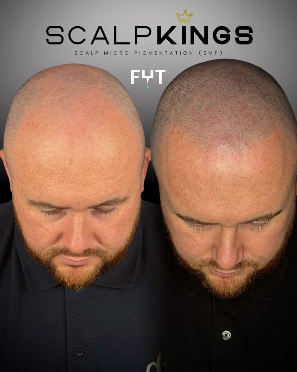 Instagram post from scalpkings. This post is in position 4.