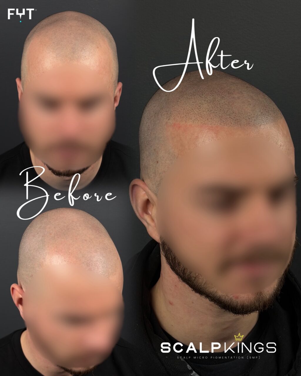 Instagram post from scalpkings. This post is in position 4.