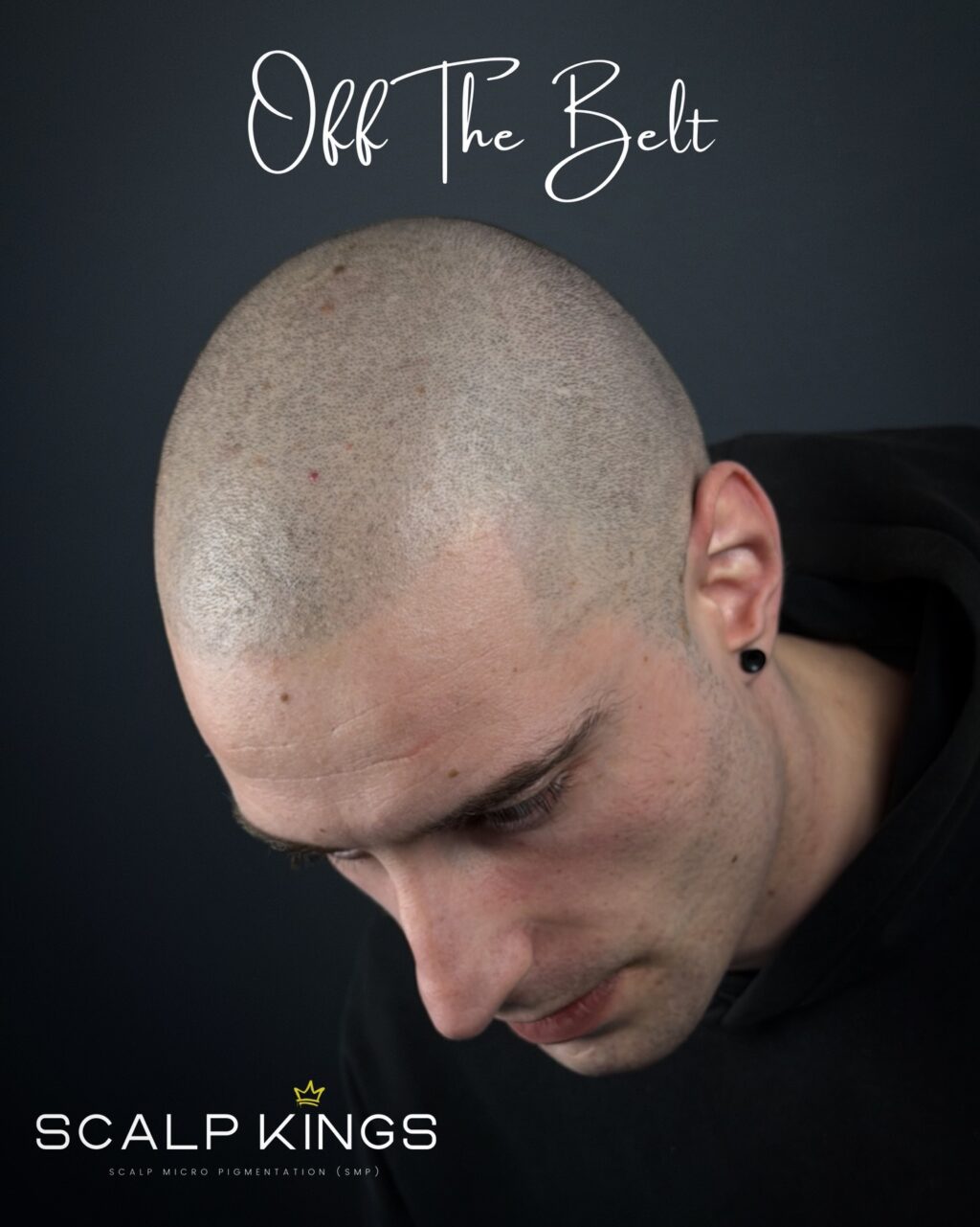 Instagram post from scalpkings. This post is in position 0.