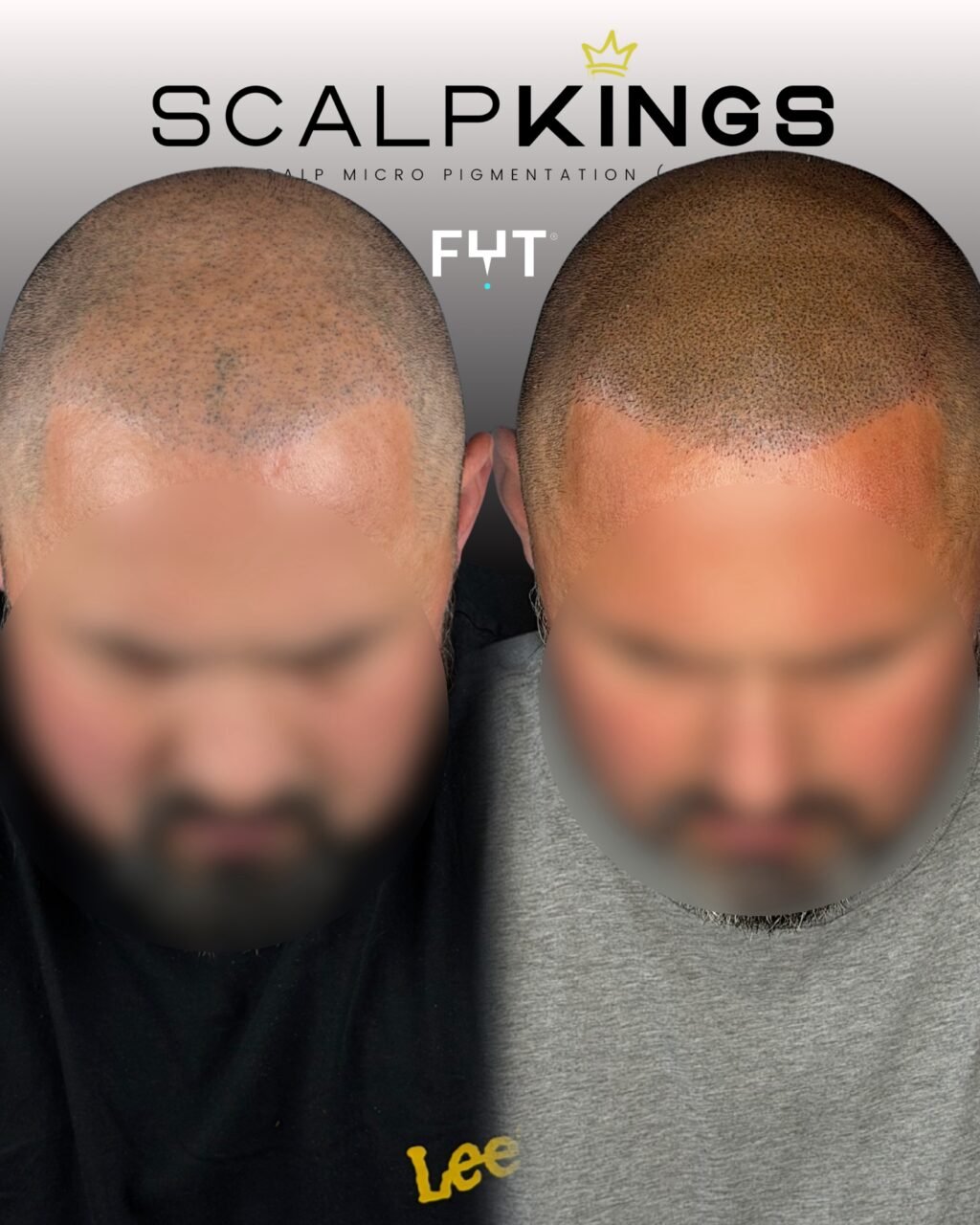 Instagram post from scalpkings. This post is in position 2.