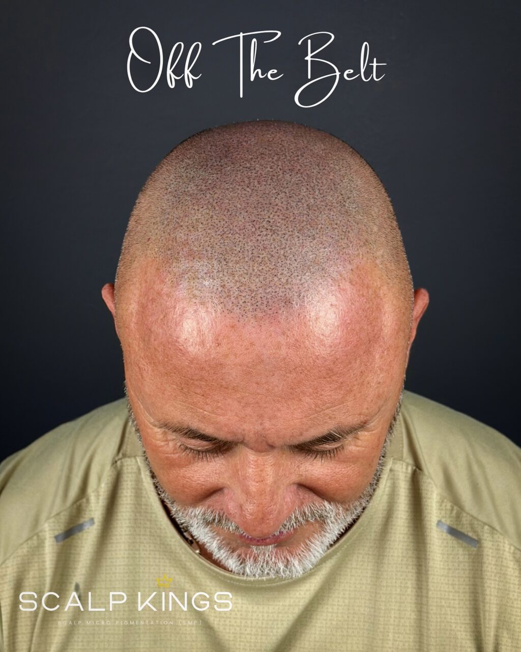 Instagram post from scalpkings. This post is in position 3.