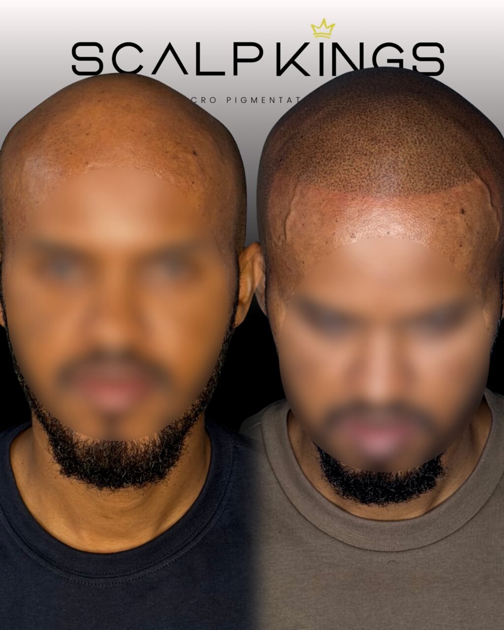 Instagram post from scalpkings. This post is in position 9.