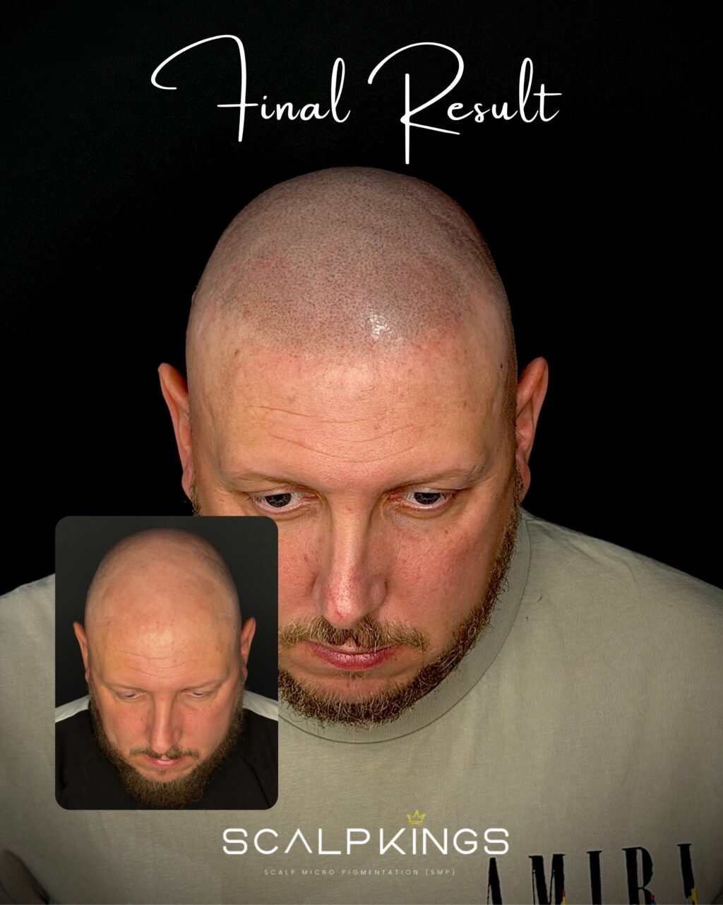Instagram post from scalpkings. This post is in position 2.