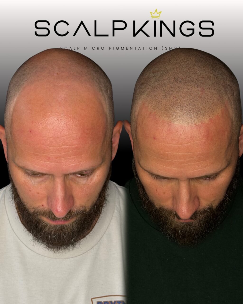 Instagram post from scalpkings. This post is in position 6.