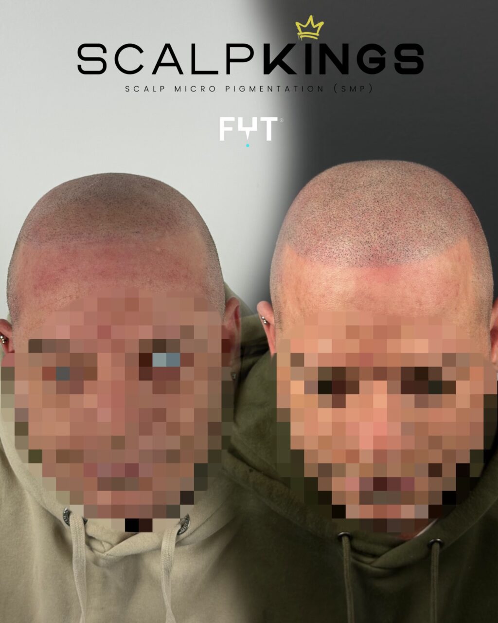 Instagram post from scalpkings. This post is in position 8.