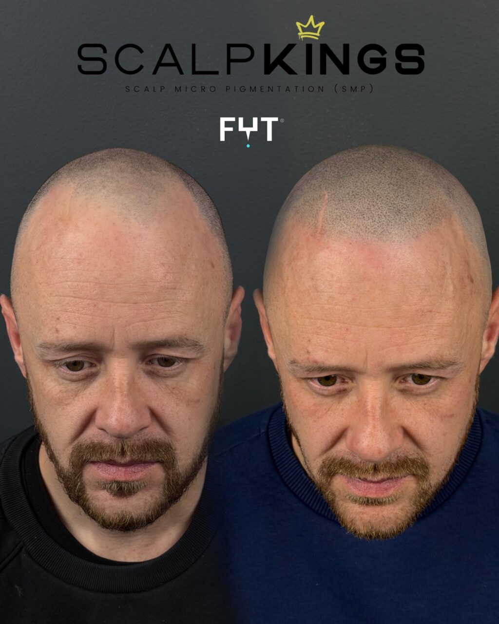 Instagram post from scalpkings. This post is in position 10.