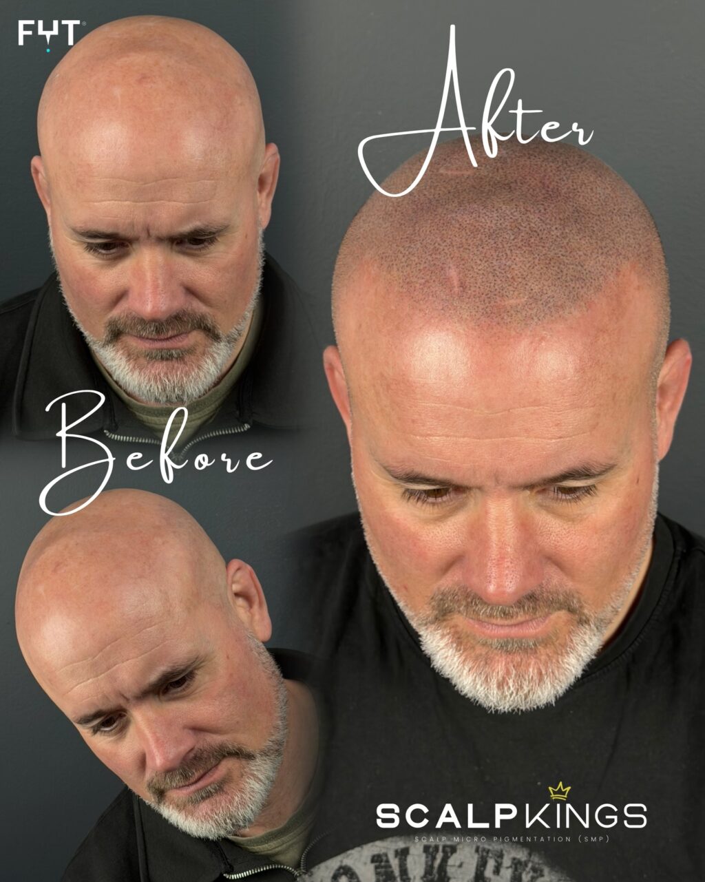 Instagram post from scalpkings. This post is in position 7.
