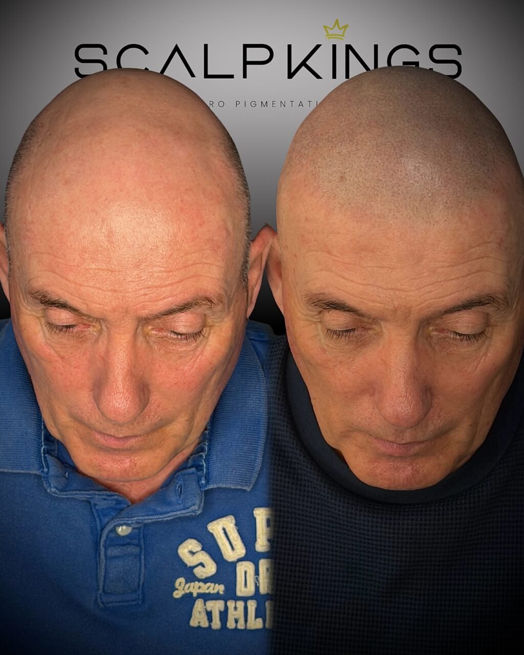 Instagram post from scalpkings. This post is in position 1.