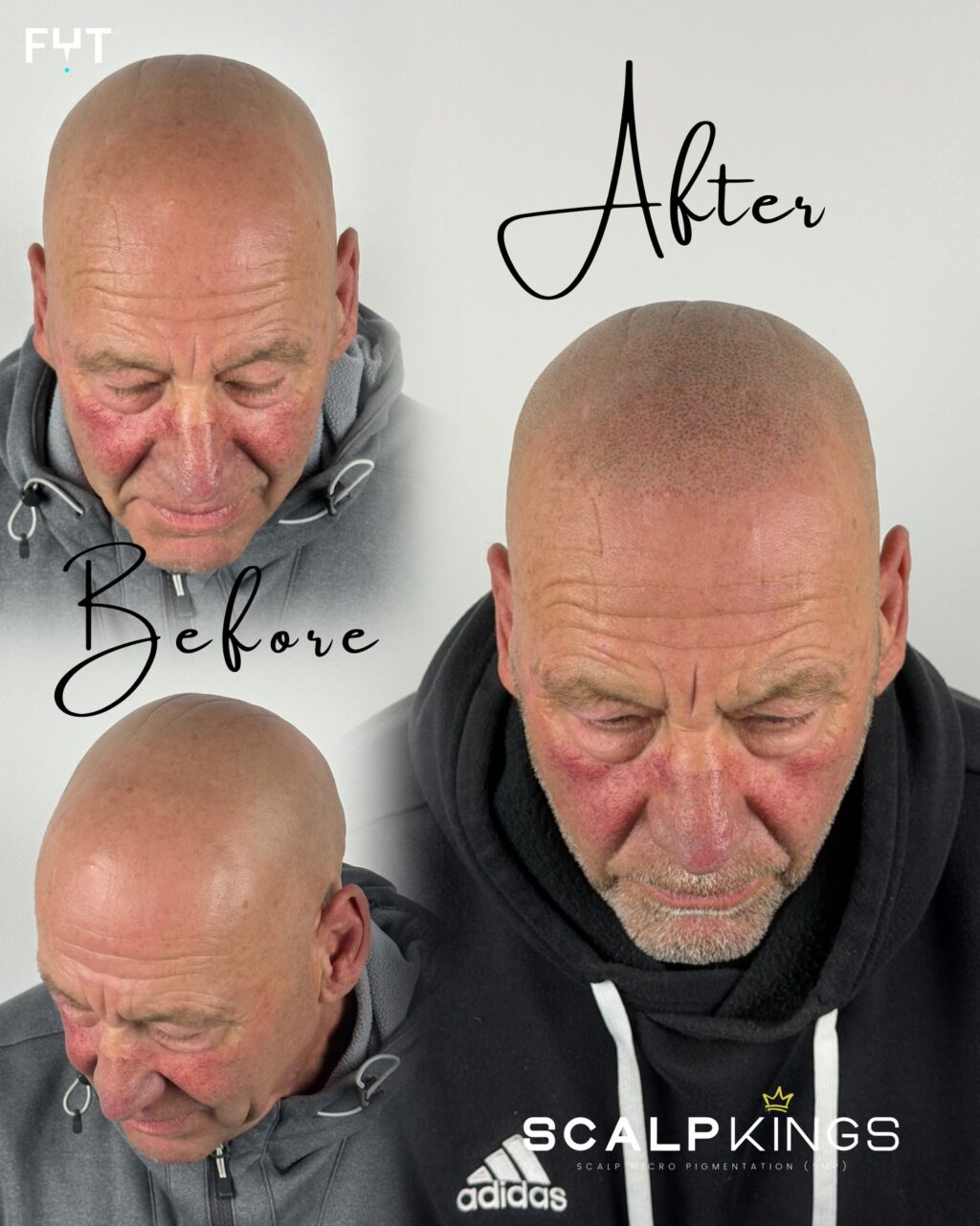 Instagram post from scalpkings. This post is in position 15.